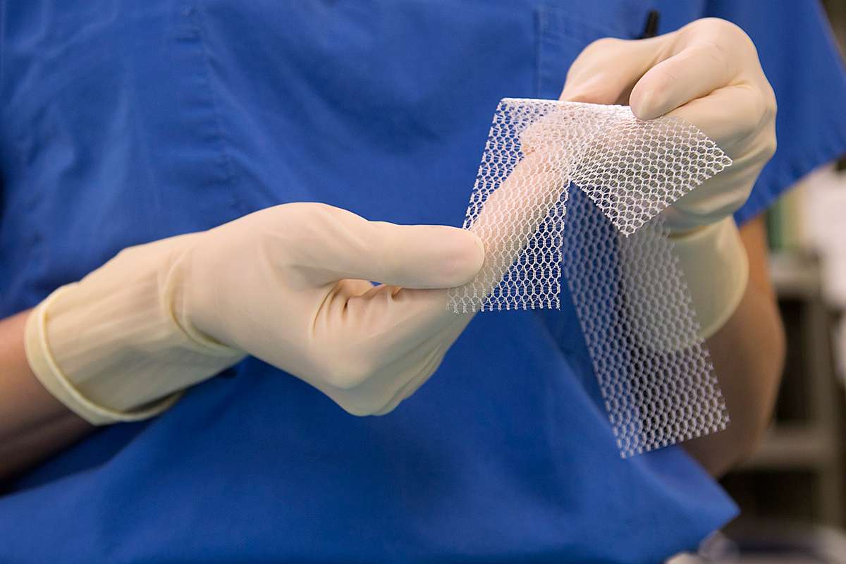 [Science] Health regulator takes step towards lifting vaginal mesh implant ban – AI