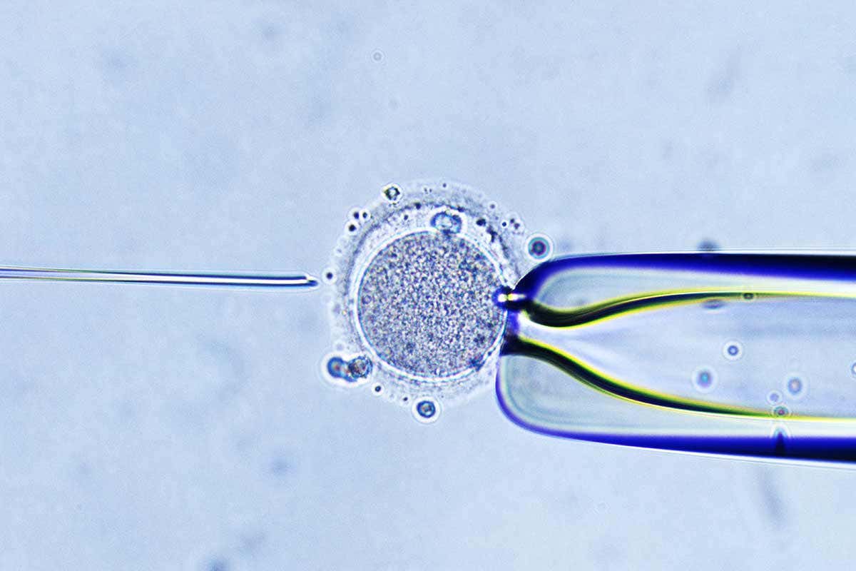[Science] Several IVF attempts can signal higher risk for any eventual pregnancy – AI