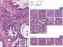 [NEWS] Google’s SMILY is reverse image search for cancer diagnosis – Loganspace