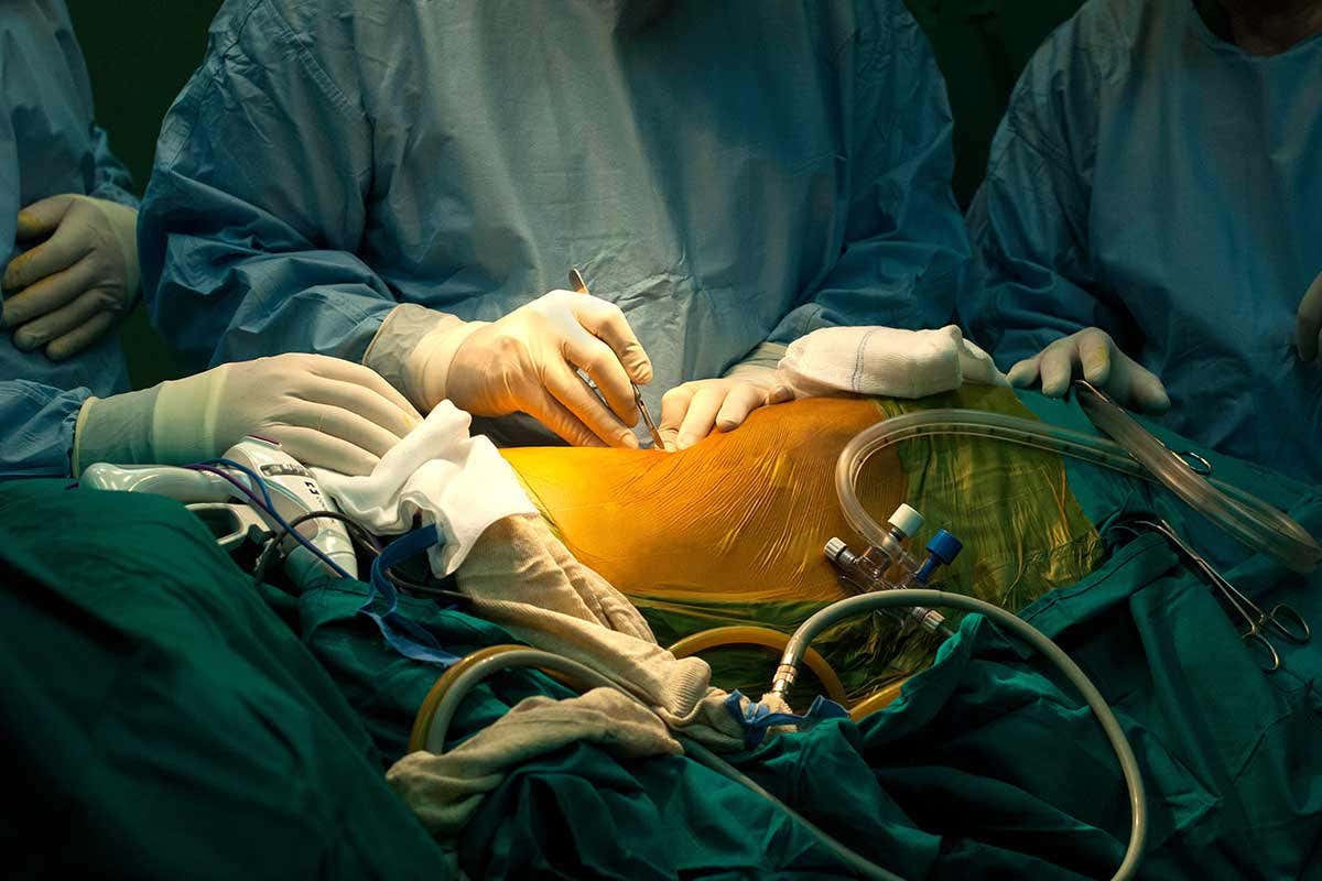 [Science] Cell injections could train the body to accept a transplanted organ – AI