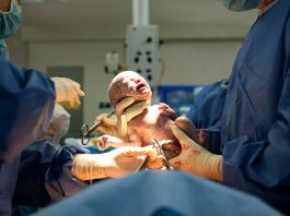 [Science] C-section babies have a different microbiome – but not for long – AI