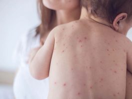 [Science] Should the UK make childhood vaccinations mandatory? – AI