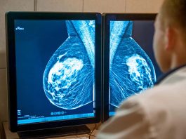 [Science] Anti-evolution drug may help treat resistant breast cancers – AI
