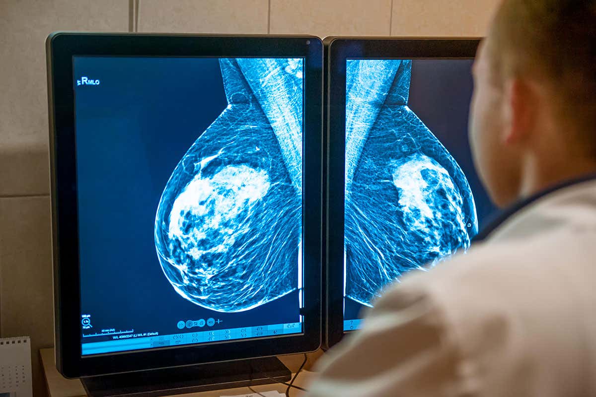 [Science] Anti-evolution drug may help treat resistant breast cancers – AI